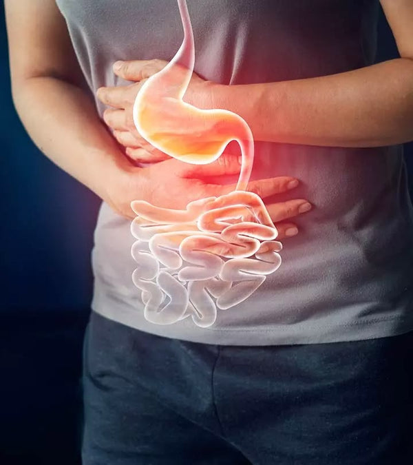 Crohn's Disease