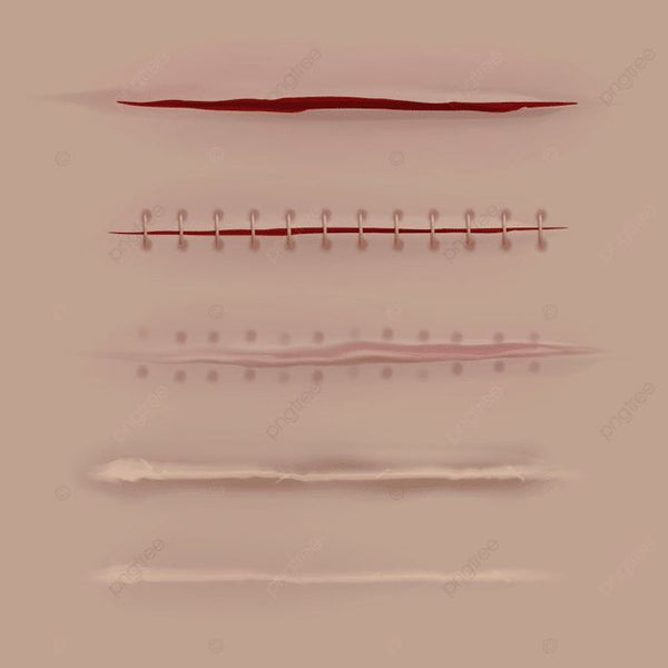 Wounds