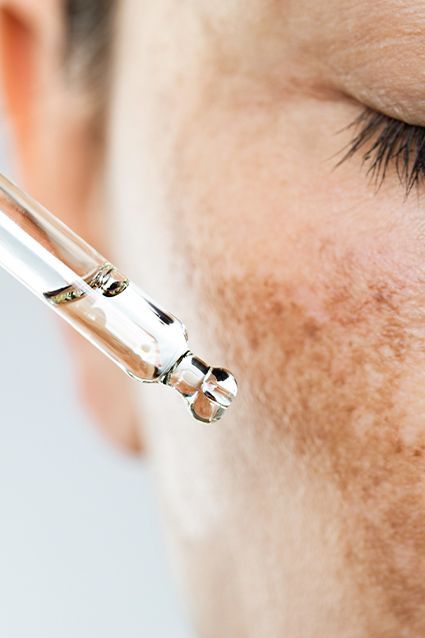 Pigmentation & Dark Spots